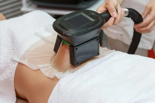 Image of person having fat freezing treatment to help weight gain East Malling
