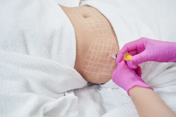 image of fat dissolving injections on love handles to help combat weight gain East Malling