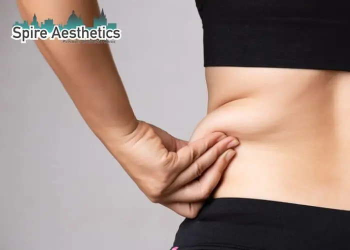 Image of woman pinching fat on their hips East Malling. Fat Freezing treatment