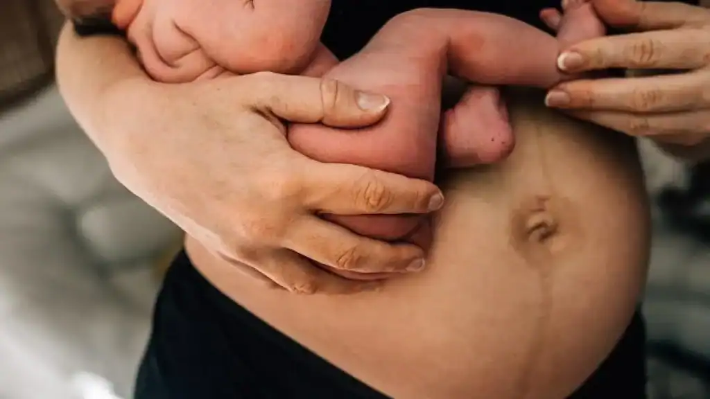 Why Is My Stomach Still Big After Pregnancy East Malling?